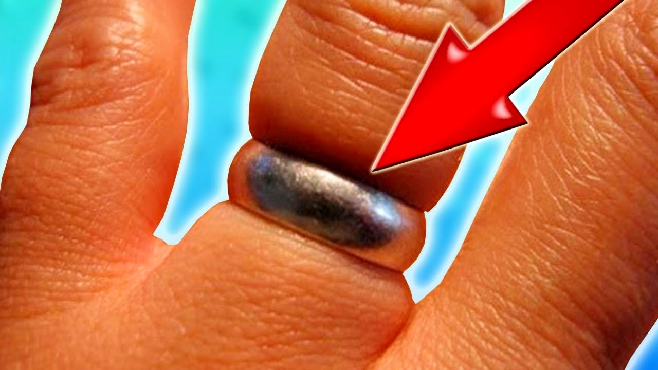 (ویدئو) اگر حلقه از انگشت تان خارج نمی شود با این روش ساده مشکل را حل کنید