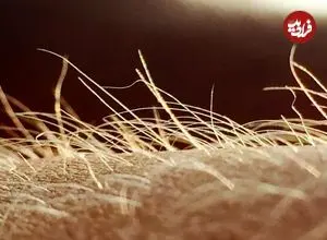 خارش احتمالا اندام حسی مخصوص به خود را دارد