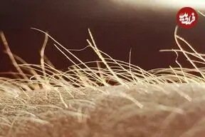 خارش احتمالا اندام حسی مخصوص به خود را دارد