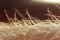 خارش احتمالا اندام حسی مخصوص به خود را دارد