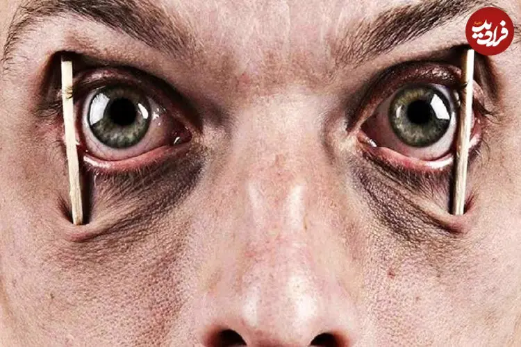 تا چند روز می‌توان بدون خواب دوام آورد؟ واقعیت رکورد ۲۶۴ ساعت چیست؟