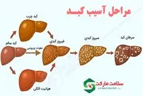 علائم کبد چرب چیست و چگونه آن را درمان کنیم؟