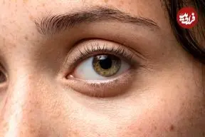  کشف راهی برای «راه‌اندازی دوباره چشم»