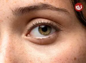  کشف راهی برای «راه‌اندازی دوباره چشم»