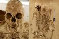 تشخیص یک بیماری ژنتیکی نادر در «اسکلت 12 هزارساله»