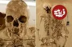 تشخیص یک بیماری ژنتیکی نادر در «اسکلت 12 هزارساله»