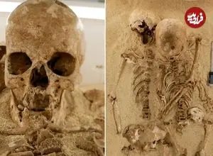 تشخیص یک بیماری ژنتیکی نادر در «اسکلت 12 هزارساله»
