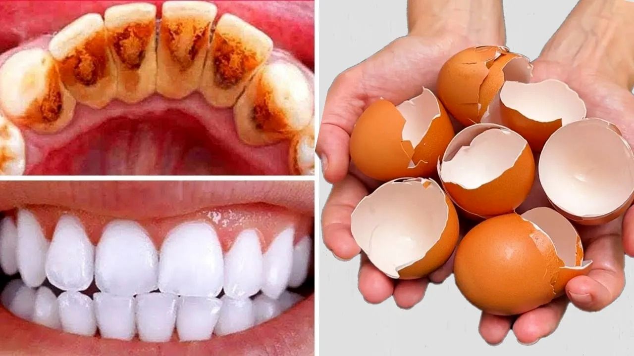 (ویدئو) یک روش خلاقانه برای سفید کردن دندان ها با پوست تخم مرغ