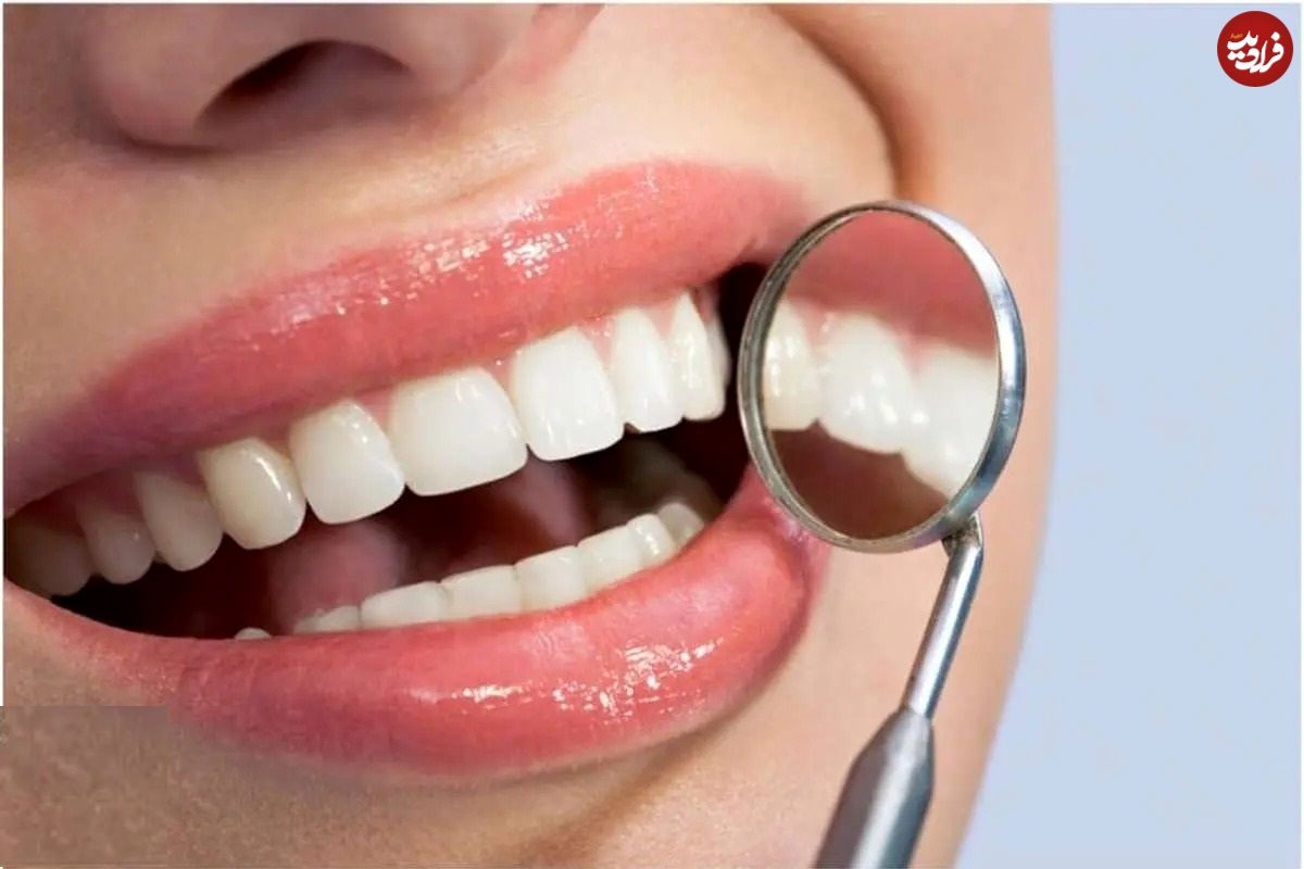 ژل شگفت‌انگیزی که در چند هفته مینای دندان را بازسازی می کند
