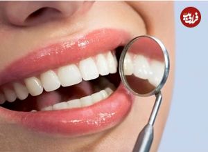 ژل شگفت‌انگیزی که در چند هفته مینای دندان را بازسازی می کند