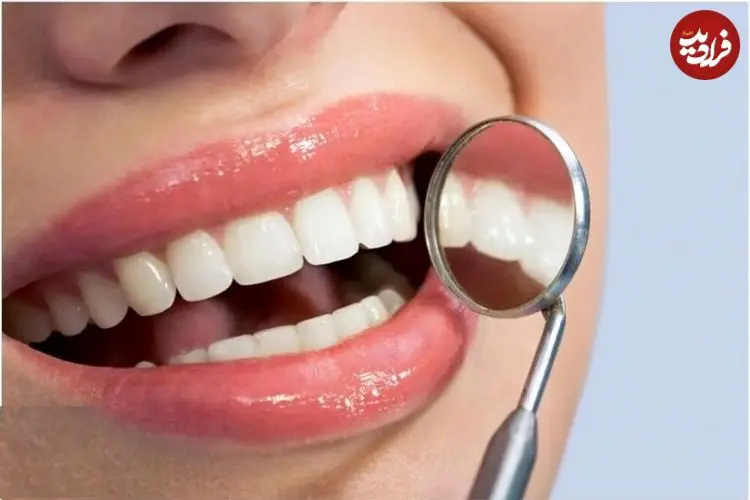 ژل شگفت‌انگیزی که در چند هفته مینای دندان را بازسازی می کند