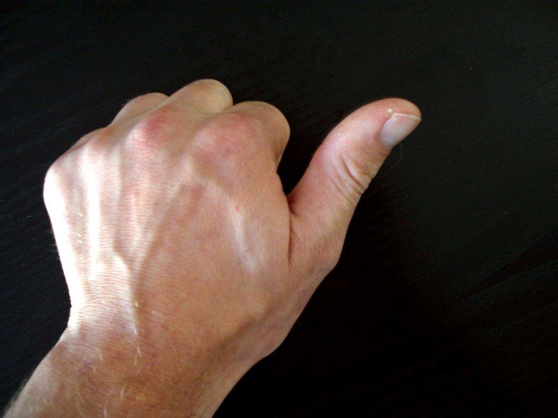 (ویدیو) ویدیویی با بازدید میلیونی؛ یک مردی با عجیب‌ترین انگشت شست جهان!