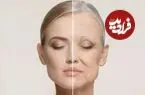 ۹ نشانه‌ که خبر از پیری زودرس بدن می‌دهد