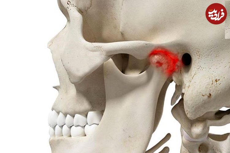 ببینید؛ دررفتگی ناگهانی فک یک مسافر هنگام خمیازه