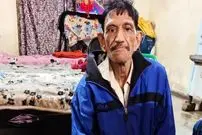 عکس| میلیونر زاغه‌نشین واقعی در هند؛ گدای جذامی با چندین خانه و خودرویی که اجاره می‌دهد