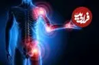چرا بدن انسان پر از نقص است؟