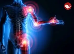 چرا بدن انسان پر از نقص است؟