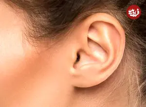 آناتومی شگفت‌انگیز لاله گوش؛ رادیاتور مخفی یا یک اشتباه تکاملی؟