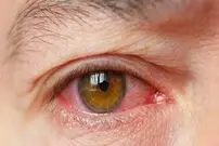 چه غذاها و نوشیدنی هایی فشار چشم را بالا می برد؟