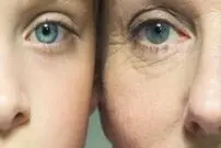 مراقبت از پوست مخصوص ۲۰ ساله‌ها