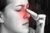بهترین روش‌های درمان سینوزیت در طب سنتی