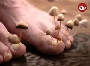 تخم‌مرغ گندیده؛ از بین برنده قارچ‌های ناخن!