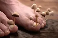تخم‌مرغ گندیده؛ از بین برنده قارچ‌های ناخن!