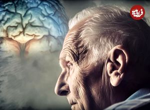 با ۷ مرحله آلزایمر آشنا شوید؛ از تغییرات خاموش تا فراموشی کامل