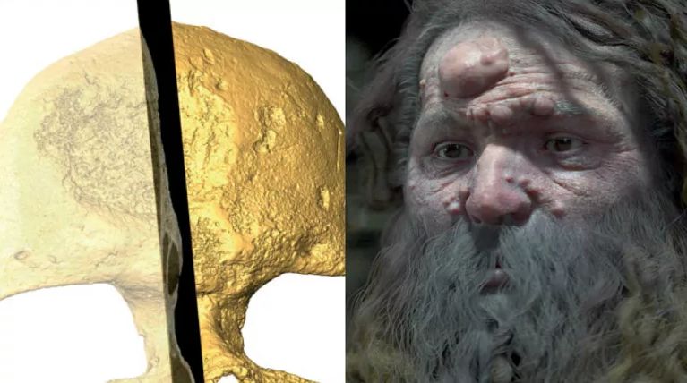 بازسازی چهرۀ انسان کرومانیون؛ دلیل وجود حفره در جمجمه کشف شد