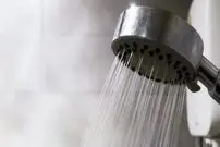 (عکس) زنی با حساسیت شدید به آب؛ فقط ۴٠ نفر در دنیا به این بیماری مبتلا هستند