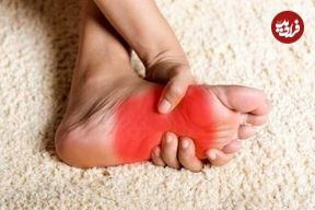 داغی و سوزش کف پا نشانه چیست؟
