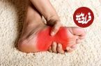 داغی و سوزش کف پا نشانه چیست؟