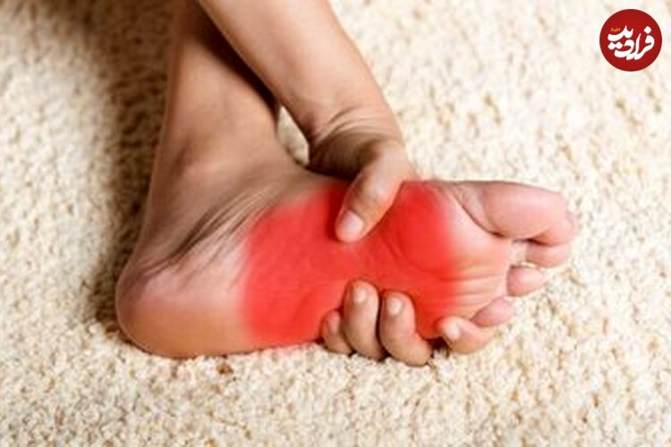 داغی و سوزش کف پا نشانه چیست؟