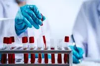 ۴ نوع آزمایش خون حیاتی که هر کسی بعد از ۴۰ سالگی باید انجام دهد