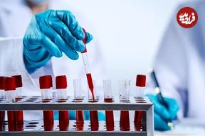 ۴ نوع آزمایش خون حیاتی که هر کسی بعد از ۴۰ سالگی باید انجام دهد