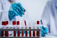 ۴ نوع آزمایش خون حیاتی که هر کسی بعد از ۴۰ سالگی باید انجام دهد