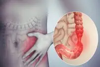 اینفوگرافیک / مواد غذایی مضر برای سلامت روده‌ها
