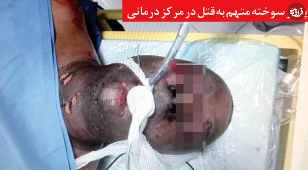 خودسوزی قاتل در لحظه دستگیری