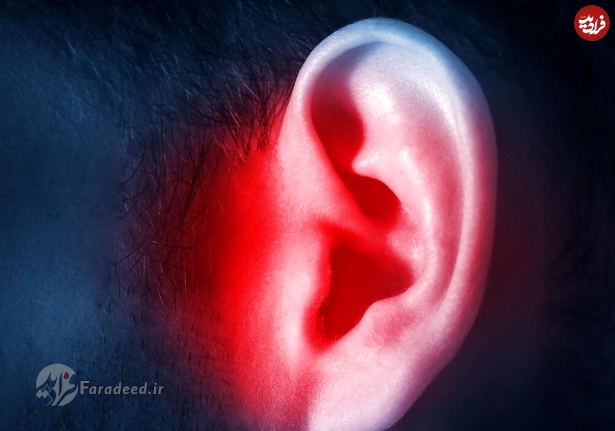 درمان گرفتگی گوش؛ علت چیست؟