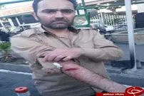 تصاویر/ حمله اراذل با قمه به ٣ نيروى شهرداری