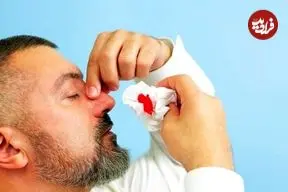 چطور خون‌دماغ را بند بیاوریم؟ | راه‌های پیشگیری از خون‌دماغ شدن