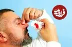 چطور خون‌دماغ را بند بیاوریم؟ | راه‌های پیشگیری از خون‌دماغ شدن