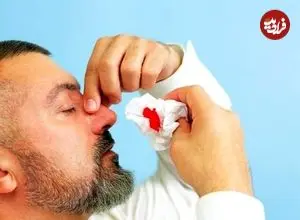 چطور خون‌دماغ را بند بیاوریم؟ | راه‌های پیشگیری از خون‌دماغ شدن