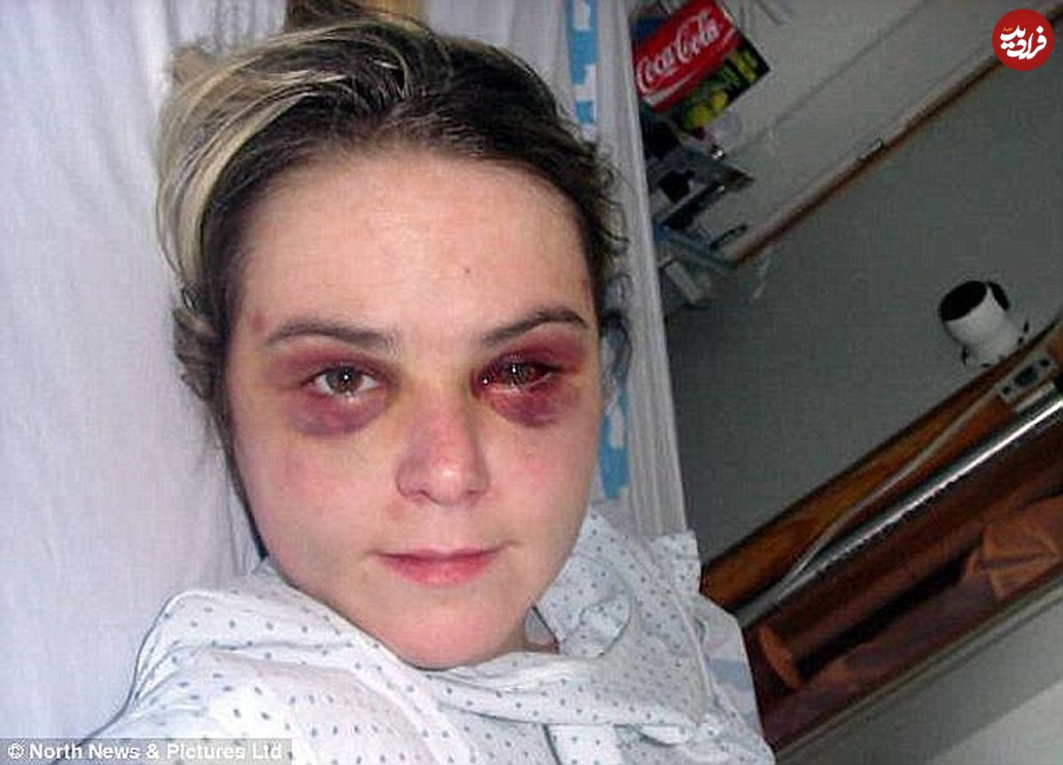 ضرب و شتم وحشیانه زن توریست پس از تجاوز