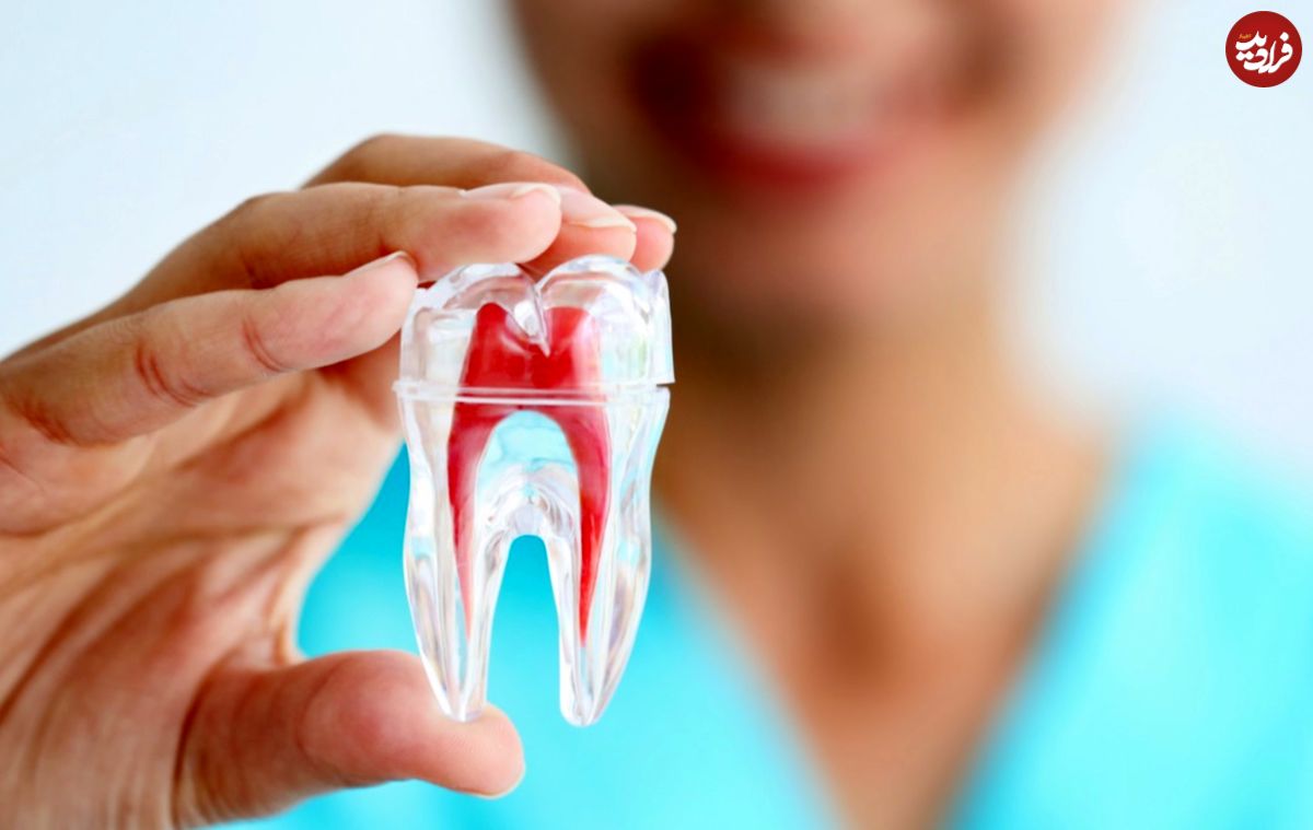 اطلاعات جامع در مورد ایمپلنت دندان