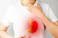 رفلاکس حنجره‌ای؛ علت پنهان گرفتگی صدا و سرفه‌های مزمن