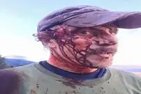 تصاویر +16/ حمله دلهره‌آور خرس گریزلی به یک شکارچی