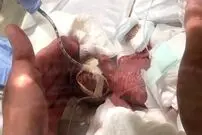 ماجرای کوچک‌ترین نوزاد پسر دنیا