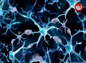 چرا مبتلایان به سرطان کمتر آلزایمر می‌گیرند؟