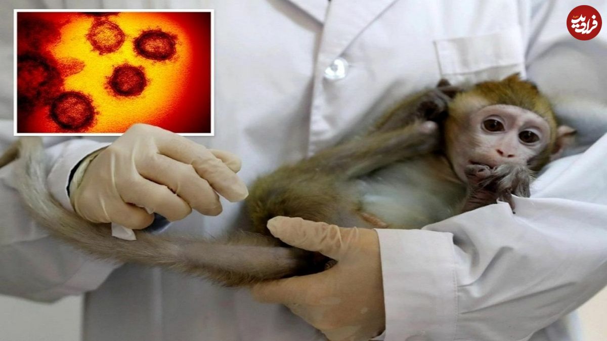 ٣٩ مورد مشکوک آبله میمونی در کشور